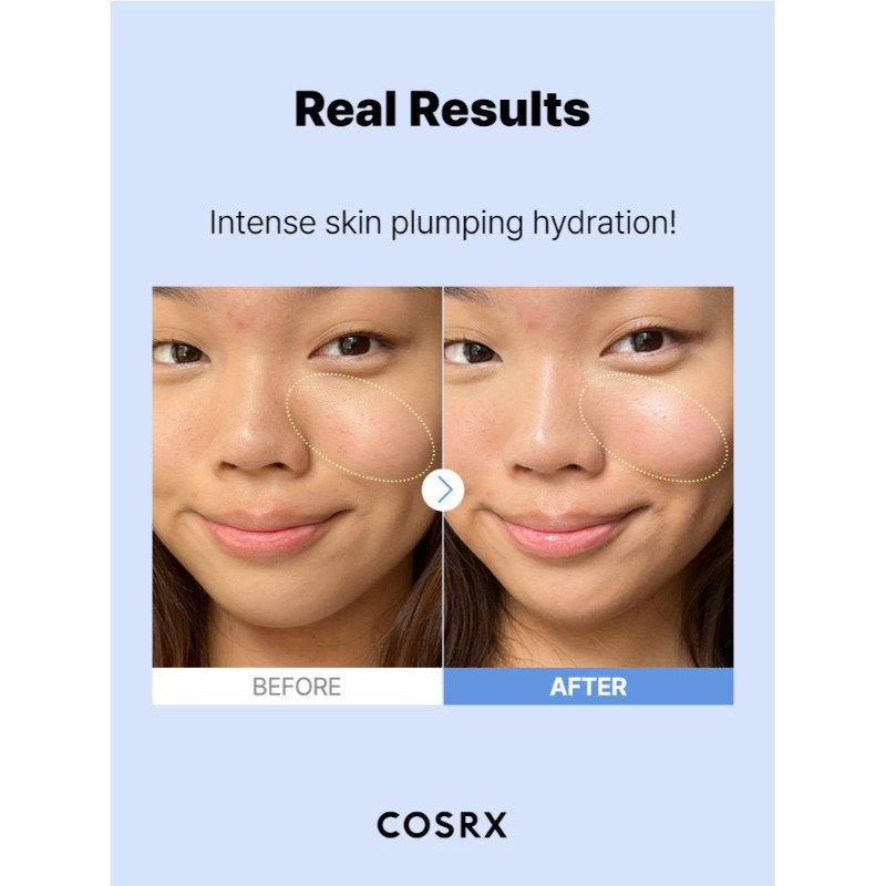 COSRX Hyaluronic acid serum 100 ml - FaceValue