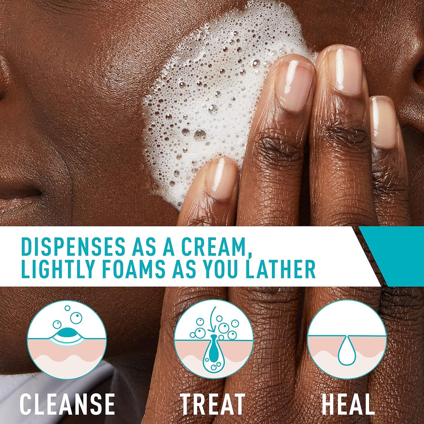 Acne Foaming Cream Cleanser - FaceValue
