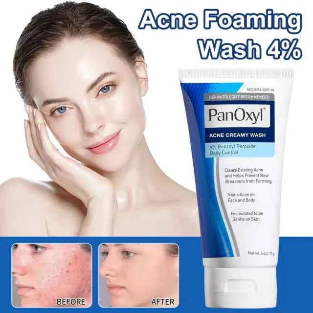 PanOxyl® Acne Creamy Wash Benzoyl Peroxide 4% 156g