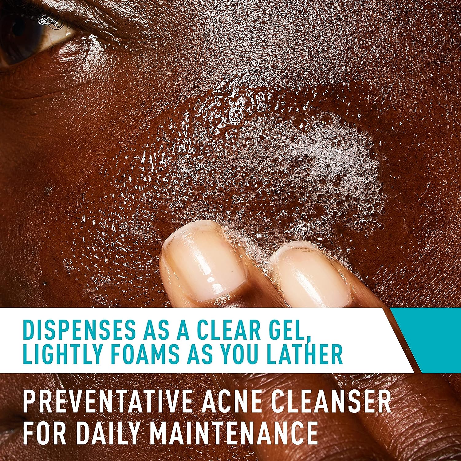 Acne Control Cleanser - FaceValue
