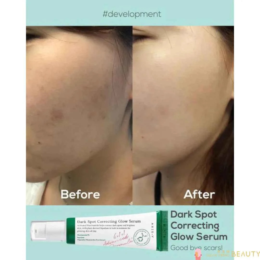 AXIS-Y Dark Spot Correcting Glow Serum (Big Size 50ML)