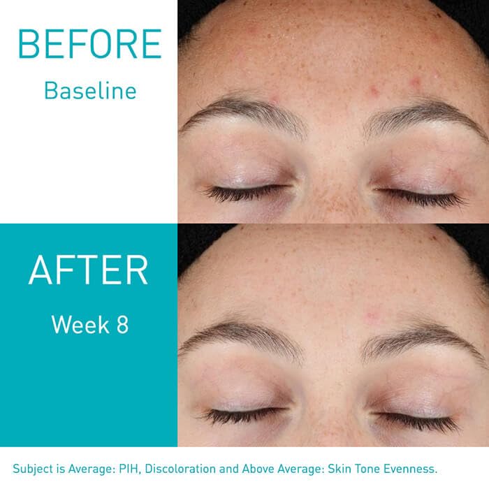 Resurfacing Retinol Serum - FaceValue